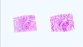 Paraffin Tissue Section - Human Adult Normal: Brain: Cerebellar Peduncles